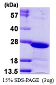 Human HP1 gamma protein, His tag. GTX68249-pro