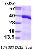 Human Monoglyceride lipase protein, His tag. GTX68252-pro