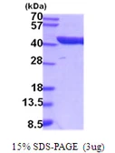 Mouse Aldolase C protein, His tag. GTX68254-pro