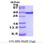 Mouse Annexin V protein, His tag. GTX68255-pro