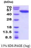 Mouse NSE protein, His tag. GTX68261-pro