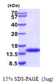 Mouse FKBP12 protein, His tag. GTX68263-pro