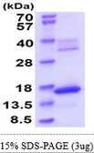 Mouse Hba-x protein, His tag. GTX68266-pro