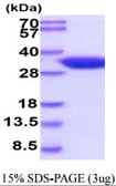 Mouse 15-PGDH protein, His tag. GTX68268-pro