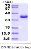 Mouse Galectin 3 protein, His tag. GTX68270-pro