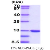Mouse Galectin 7 protein, His tag. GTX68271-pro