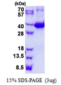 Mouse Galectin 9 protein, His tag. GTX68272-pro