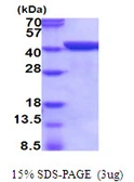 Mouse Annexin A1 protein, His tag. GTX68273-pro