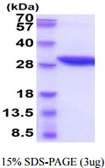 Mouse NNMT protein, His tag. GTX68276-pro