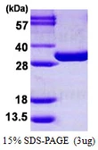 Mouse PGAM1 protein, His tag. GTX68278-pro