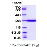 Mouse Recoverin protein, His tag. GTX68281-pro