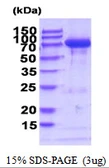 Mouse Transglutaminase 2 protein, His tag. GTX68295-pro