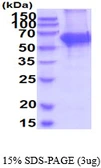 Mouse Tyrosine Hydroxylase protein, His tag. GTX68296-pro