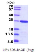 Mouse TCTP protein, His tag. GTX68297-pro
