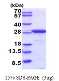 Mouse PGP9.5 protein, His tag. GTX68298-pro
