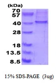 Human RALY protein, His tag. GTX68300-pro
