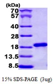 Human NCBP2 protein, His tag. GTX68301-pro
