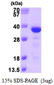 Human EB3 protein, His tag. GTX68303-pro