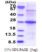 Human POMZP3 protein, His tag. GTX68305-pro
