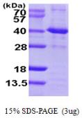 Human SIRT2 protein, His tag. GTX68306-pro