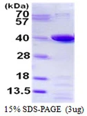 Human PTGR1 protein, His tag. GTX68309-pro