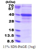 Human EXOSC7 protein, His tag. GTX68311-pro