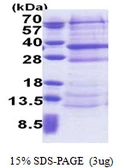 Human DCUN1D4 protein, His tag. GTX68313-pro