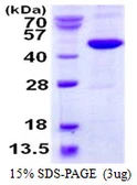 Human METAP1 protein, His tag. GTX68316-pro