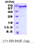 Human PSR protein, His tag. GTX68318-pro