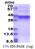 Human TBC1D1 protein, His tag. GTX68319-pro