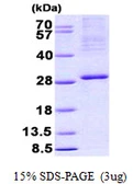 Human ITGB3BP protein, His tag. GTX68324-pro