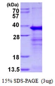 Human DEDAF protein, His tag. GTX68325-pro
