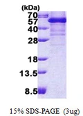 Human TDP43 protein, His tag. GTX68326-pro