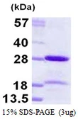 Human HP1 alpha protein, His tag. GTX68328-pro