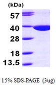 Human QPRT protein, His tag. GTX68329-pro