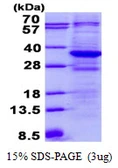 Human TTC33 protein, His tag. GTX68331-pro