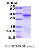 Human RASD2 protein, His tag. GTX68332-pro