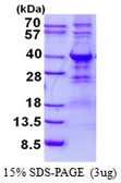 Human WBP2 protein, His tag. GTX68334-pro