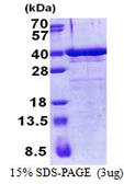 Human ZNF346 protein, His tag. GTX68335-pro