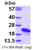 Human ARL2BP protein, His tag. GTX68336-pro