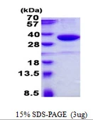 Human SMUG1 protein, His tag. GTX68338-pro