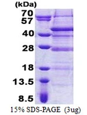 Human C17orf81 protein, His tag. GTX68339-pro