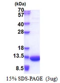 Human LSM5 protein, His tag. GTX68345-pro