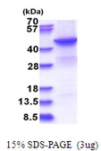 Human BHMT2 protein, His tag. GTX68347-pro
