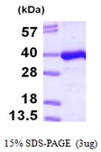Human PITPNB protein, His tag. GTX68348-pro