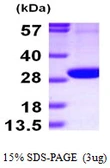 Human PGLS protein, His tag. GTX68353-pro