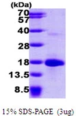 Human LSM4 protein, His tag. GTX68355-pro
