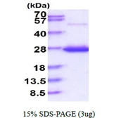 Human TNFAIP8 protein, His tag. GTX68356-pro
