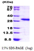 Human MOBKL3 protein, His tag. GTX68358-pro