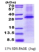 Human Pirh2 protein, His tag. GTX68361-pro